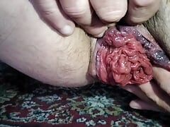 Close Up prolapsing rosebud