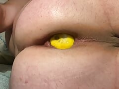 Limon insertion