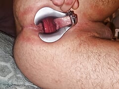 Stretching gaping hole for cucumber
